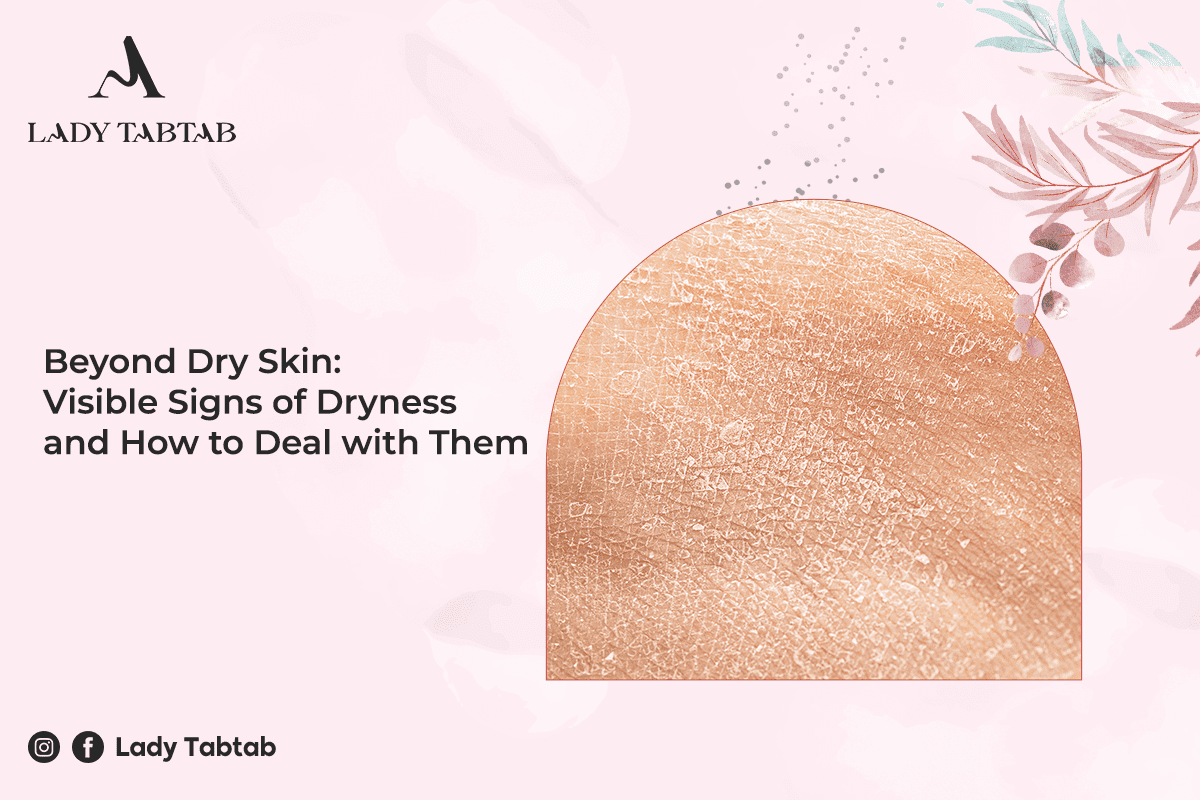 Beyond Dry Skin: Visible Signs of Dryness and How to Deal with Them