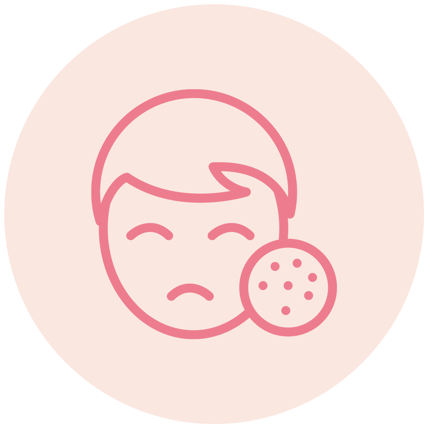 البقع والتصبغات